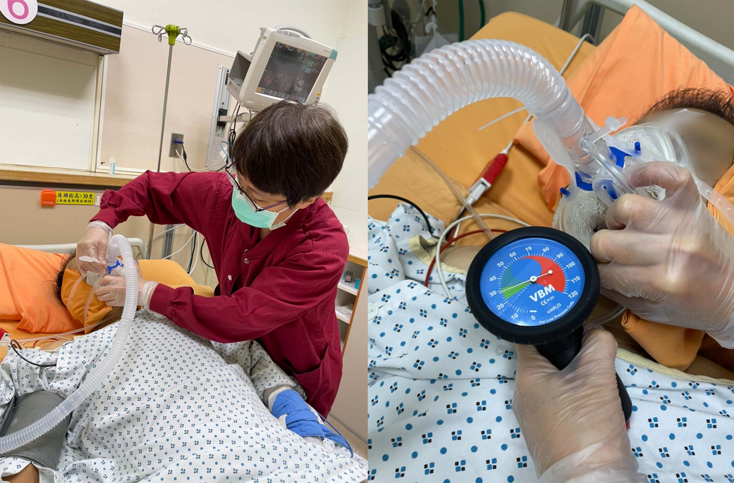 小港醫院郭昭宏院長 氧氣面罩壓力最佳範圍 加護病房有效預防壓傷發生