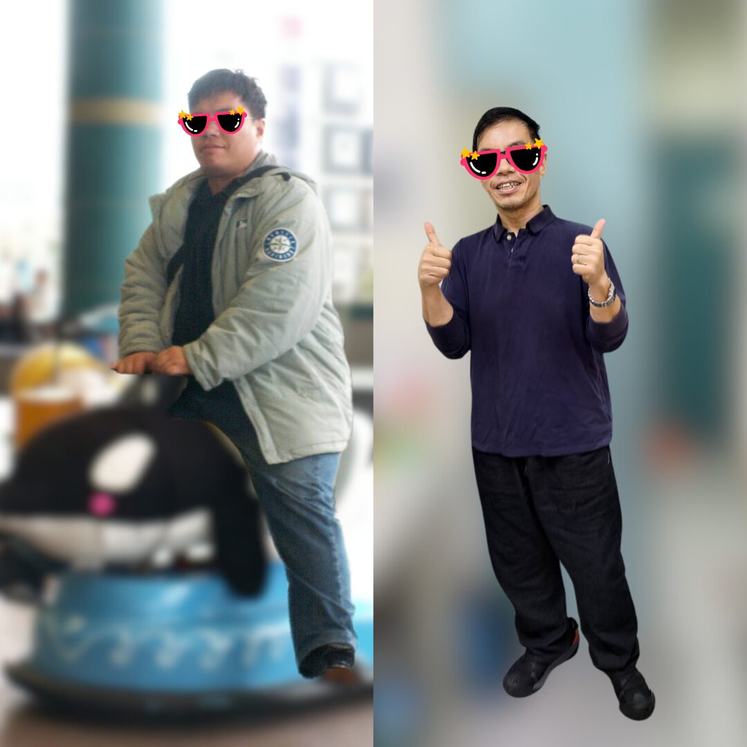 小港醫院透過「內視鏡袖狀胃成形術」助夫妻檔甩肉50公斤 找回健康與自信