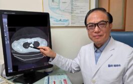 久咳不癒竟藏危機 LDCT助主婦揪出早期肺癌